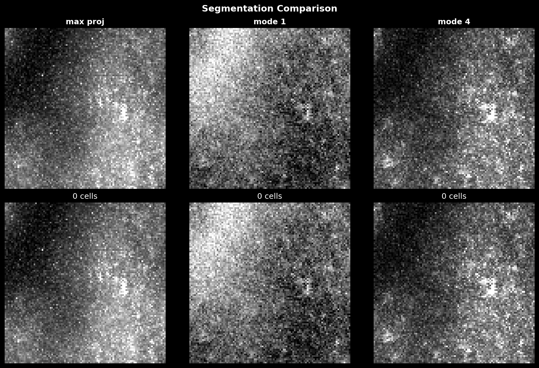 Segmentation Comparison