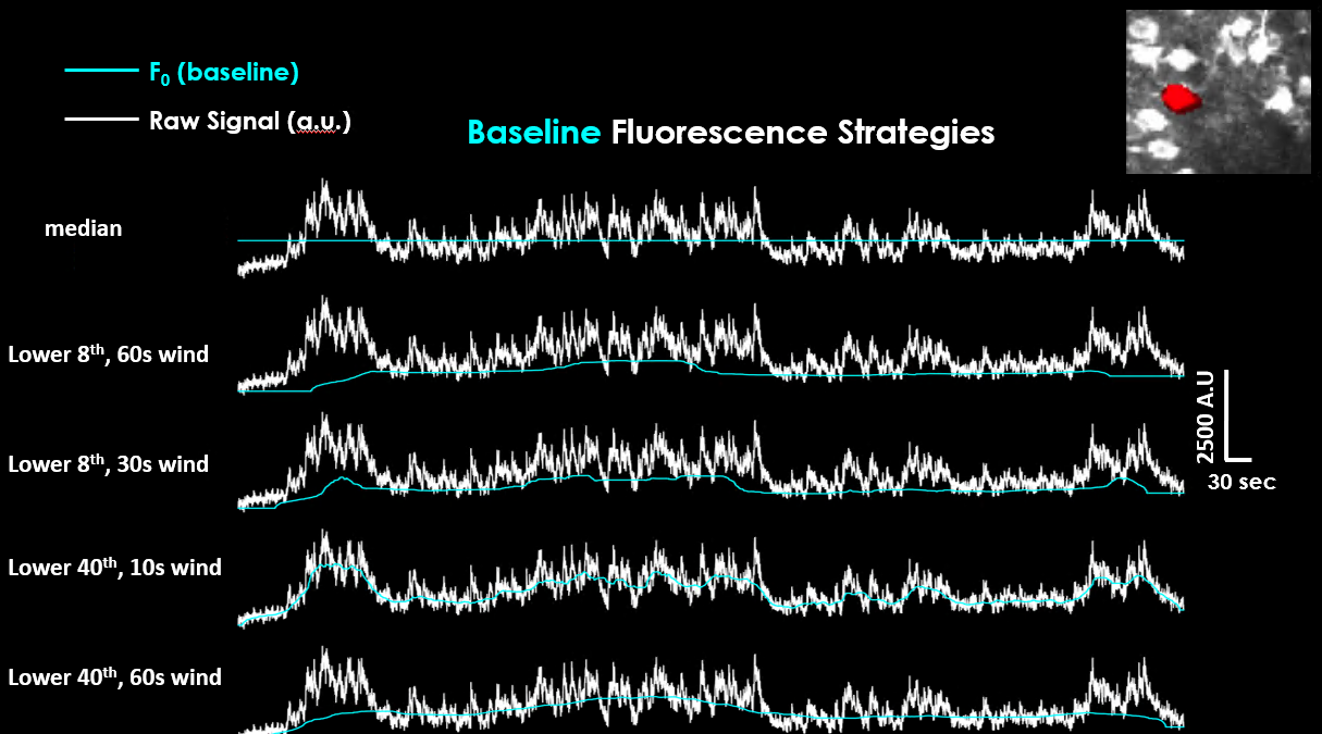 Comparison of dF/F baseline strategies